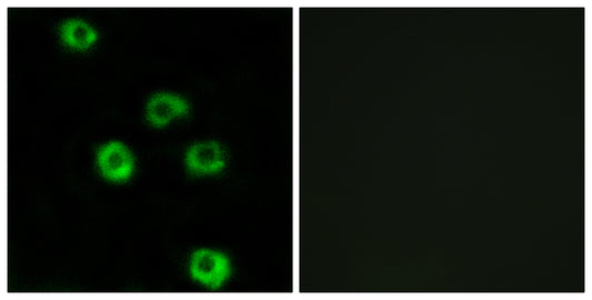 Latrophilin-2 Rabbit Polyclonal Antibody