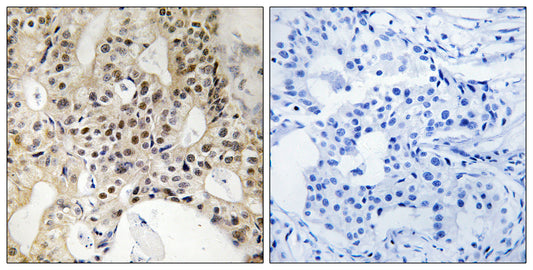 LATS1/2 Rabbit Polyclonal Antibody