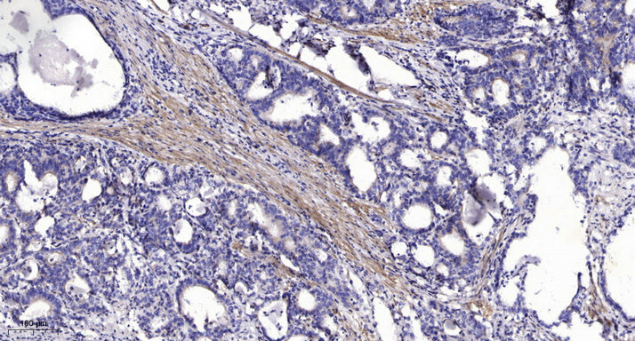 Lck BP-1 Rabbit Polyclonal Antibody