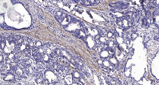 Lck BP-1 Rabbit Polyclonal Antibody