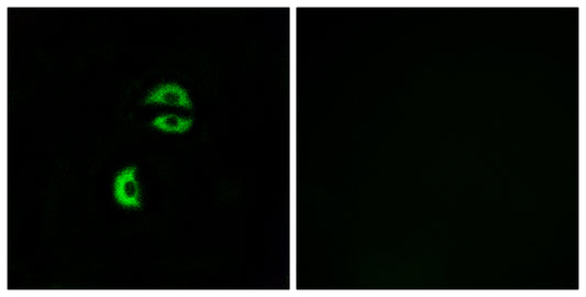 LDLRAD3 Rabbit Polyclonal Antibody