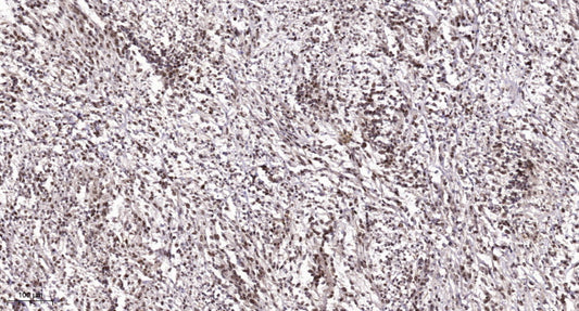 LDOC1 Rabbit Polyclonal Antibody