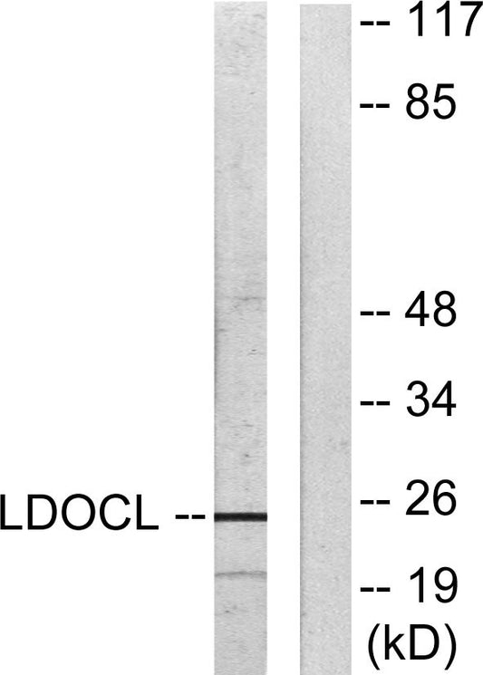 LDOC1L Rabbit Polyclonal Antibody