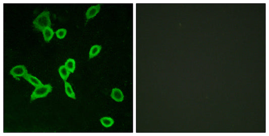 LGR6 Rabbit Polyclonal Antibody