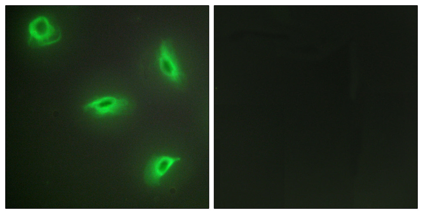 LIGHT Rabbit Polyclonal Antibody