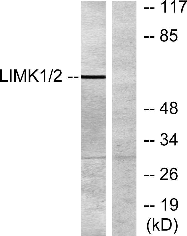LIMK-1 Rabbit Polyclonal Antibody