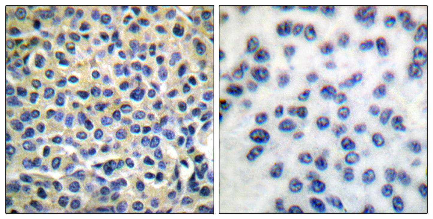 LIMK-1/2 Rabbit Polyclonal Antibody