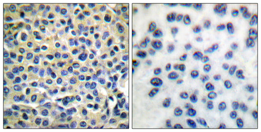 LIMK-1/2 Rabbit Polyclonal Antibody