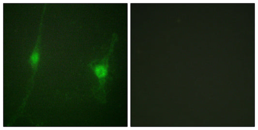 LKB1 Rabbit Polyclonal Antibody