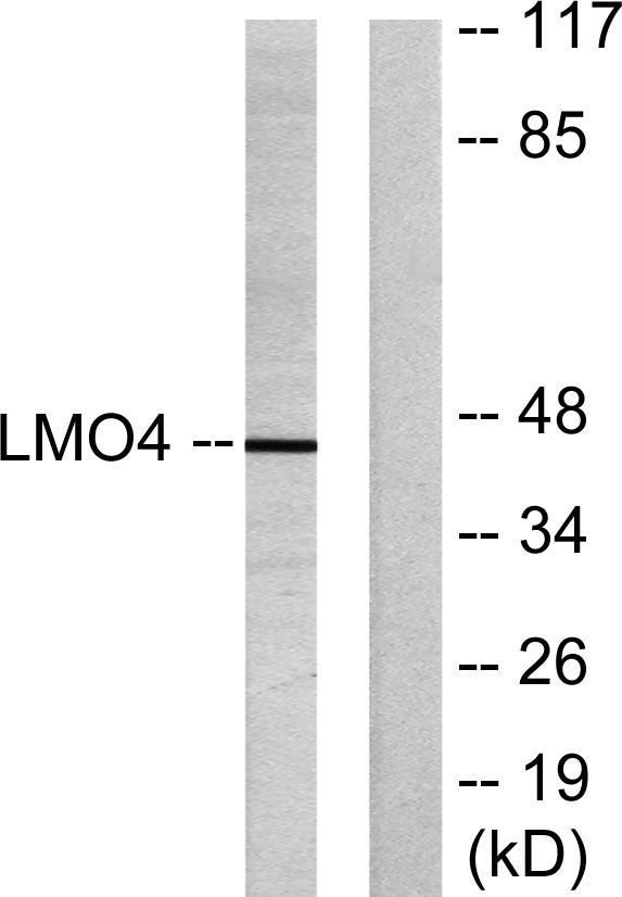 LMO4 Rabbit Polyclonal Antibody