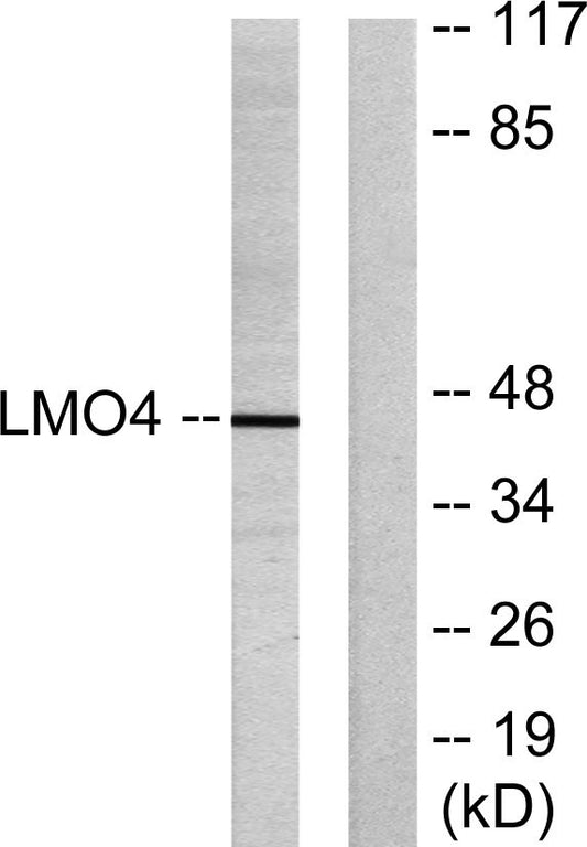 LMO4 Rabbit Polyclonal Antibody