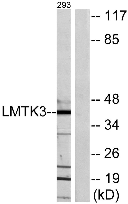 LMTK3 Rabbit Polyclonal Antibody