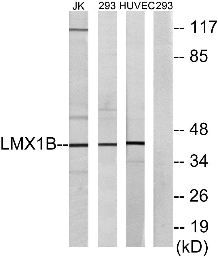 LMX1B Rabbit Polyclonal Antibody