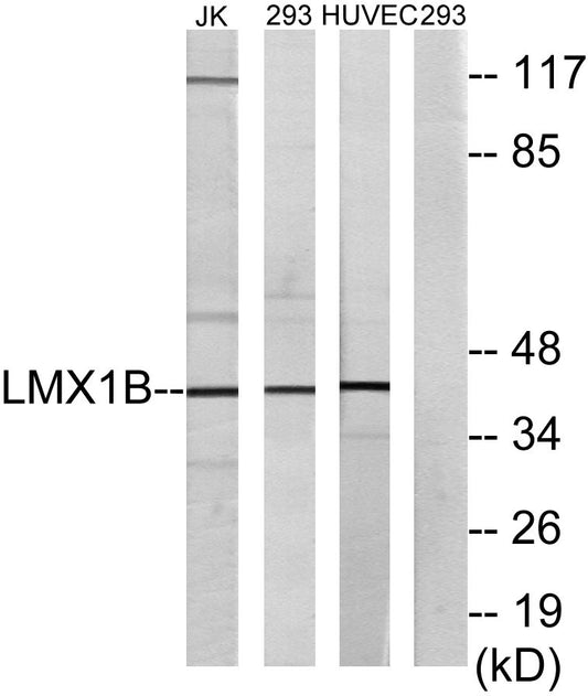 LMX1B Rabbit Polyclonal Antibody