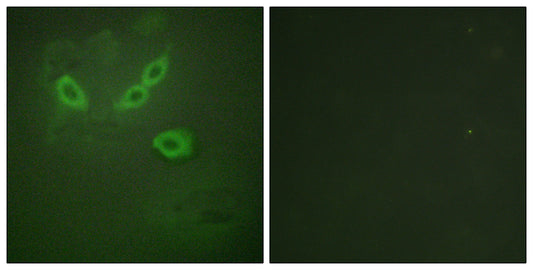 LOST1 Rabbit Polyclonal Antibody