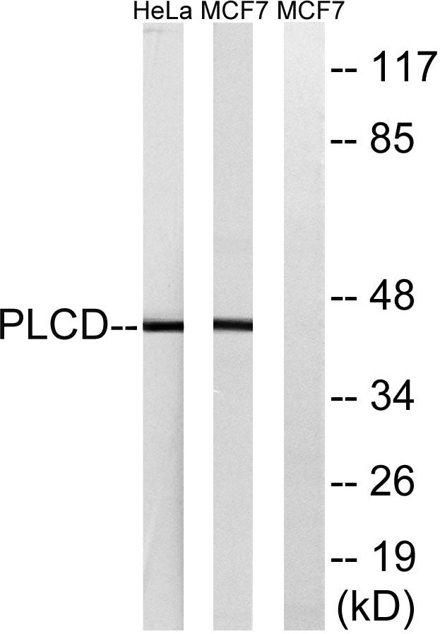LPAAT-δ Rabbit Polyclonal Antibody