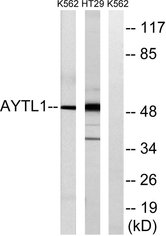 LPCAT2 Rabbit Polyclonal Antibody