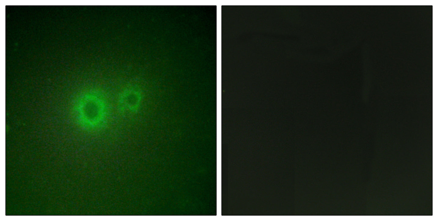 LRAT Rabbit Polyclonal Antibody