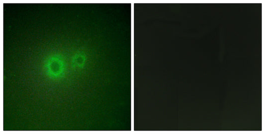 LRAT Rabbit Polyclonal Antibody