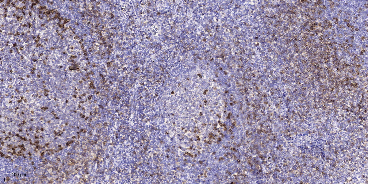 LRBA Rabbit Polyclonal Antibody