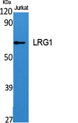 LRG1 Rabbit Polyclonal Antibody