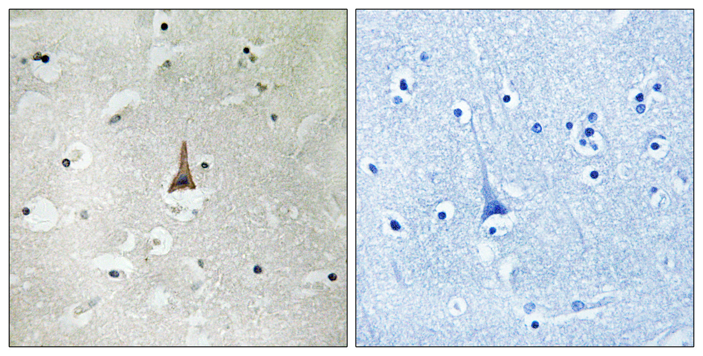 LRP10 Rabbit Polyclonal Antibody