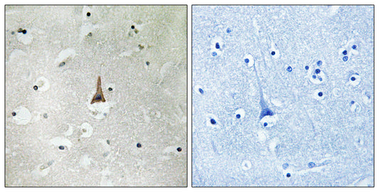 LRP10 Rabbit Polyclonal Antibody