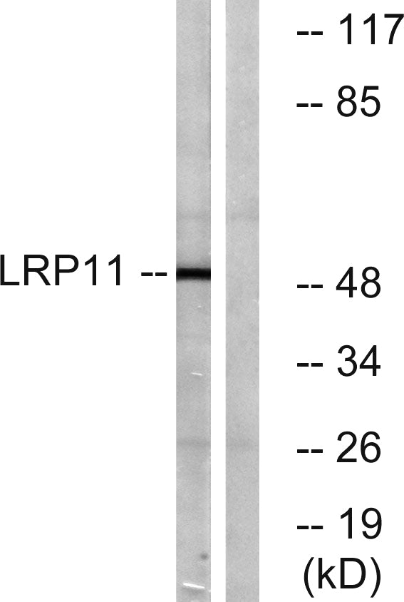 LRP11 Rabbit Polyclonal Antibody