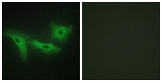 LRRK1 Rabbit Polyclonal Antibody