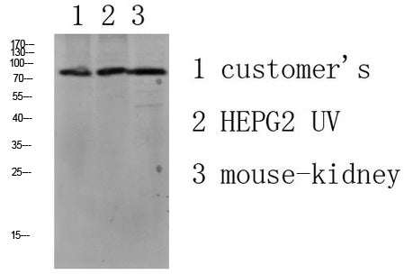 LSHR Rabbit Polyclonal Antibody