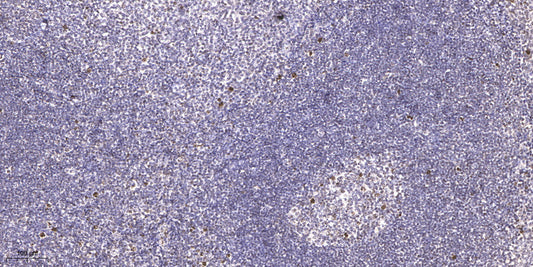 LSM2 Rabbit Polyclonal Antibody
