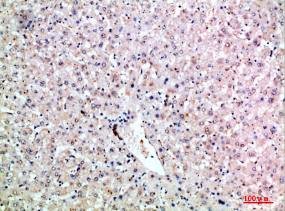 LT-β Rabbit Polyclonal Antibody
