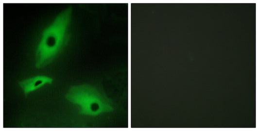 LTβR Rabbit Polyclonal Antibody