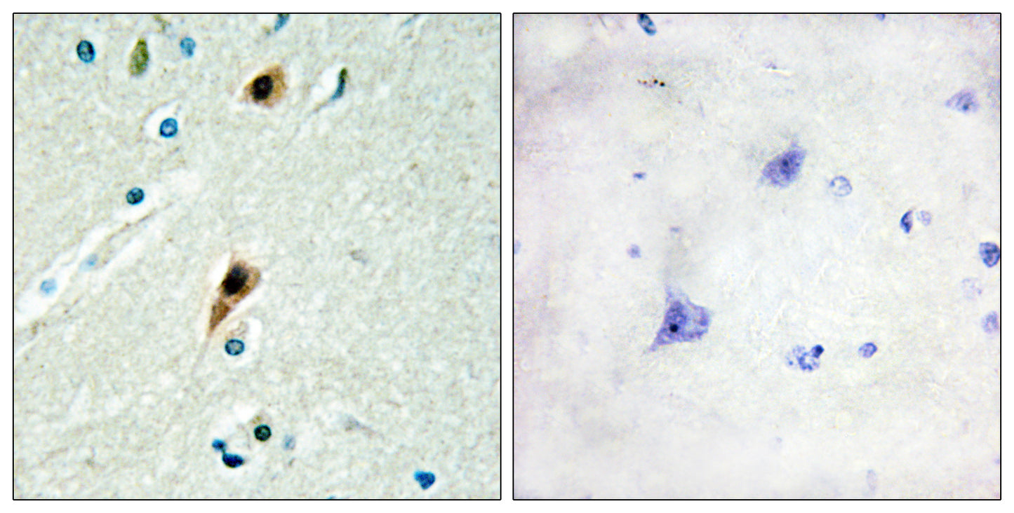 LUCA15 Rabbit Polyclonal Antibody