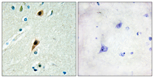 LUCA15 Rabbit Polyclonal Antibody