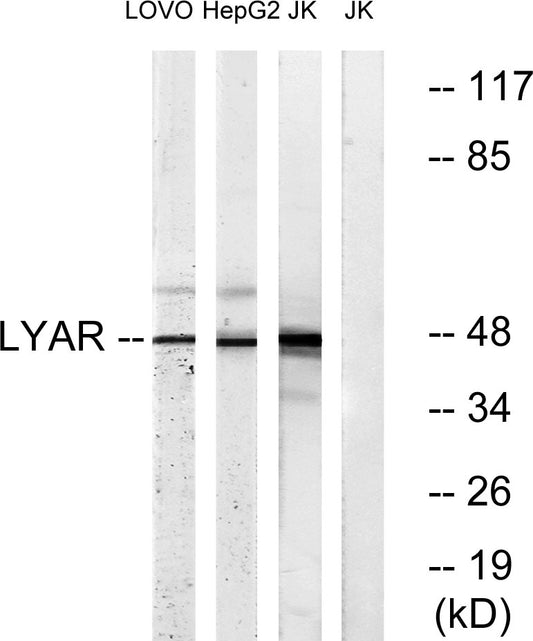LYAR Rabbit Polyclonal Antibody