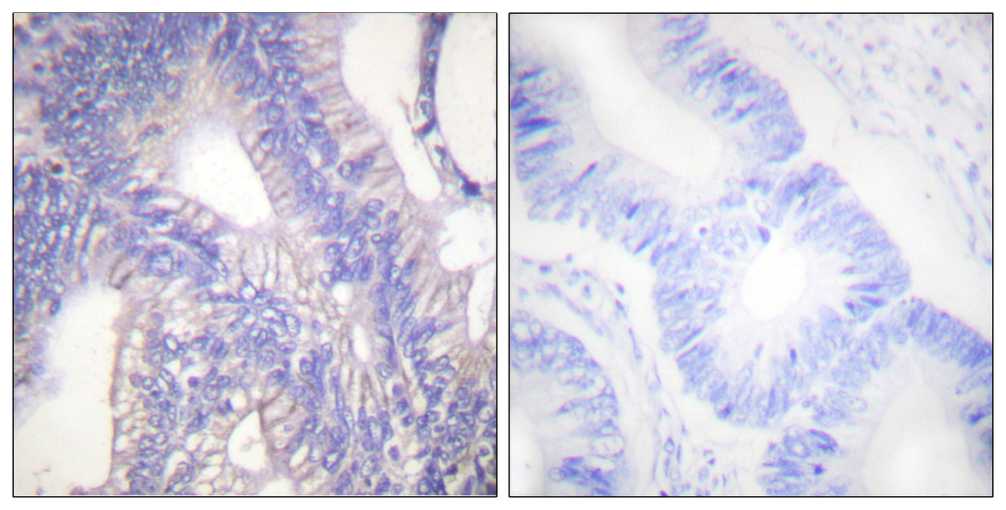 Lyn Rabbit Polyclonal Antibody