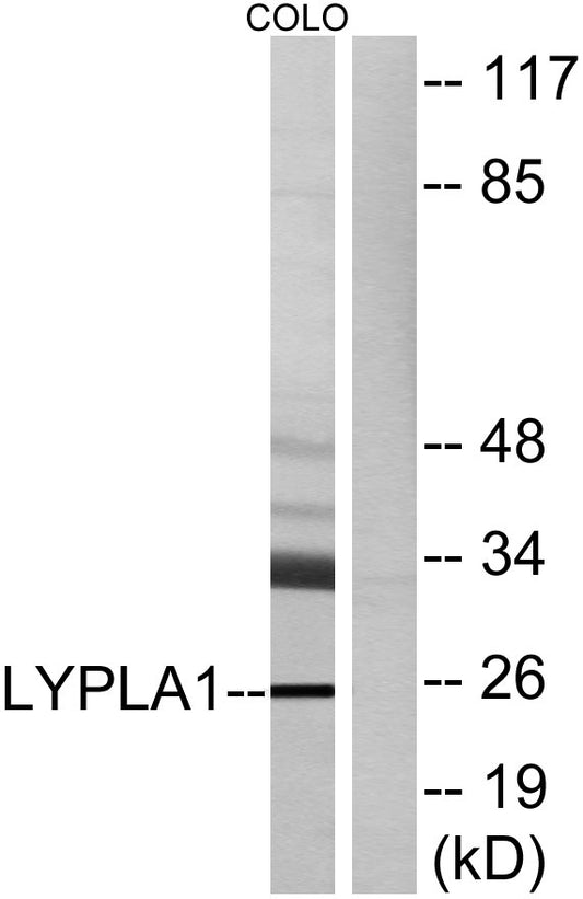 LYPLA1 Rabbit Polyclonal Antibody