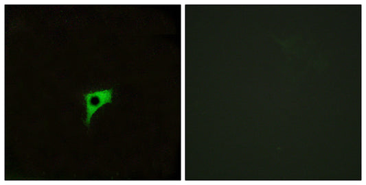 mAChR M2 Rabbit Polyclonal Antibody