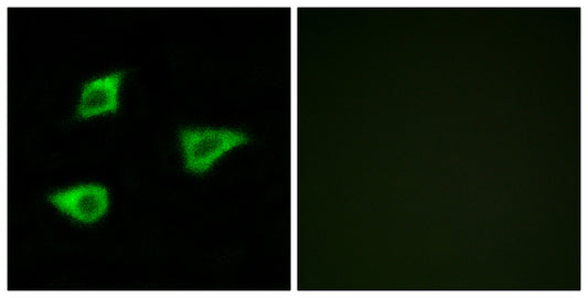 mAChR M4 Rabbit Polyclonal Antibody