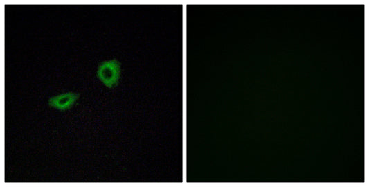 mAChR M5 Rabbit Polyclonal Antibody