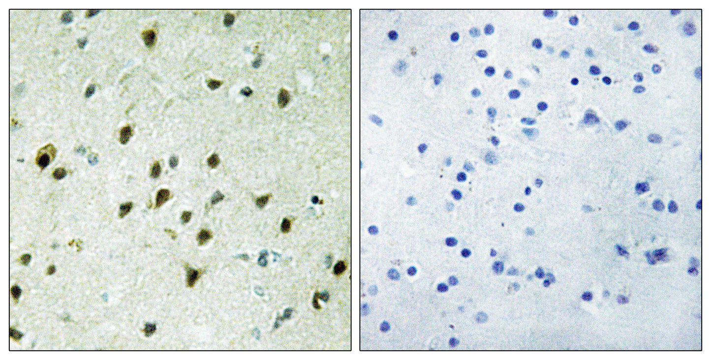 Mad 4 Rabbit Polyclonal Antibody