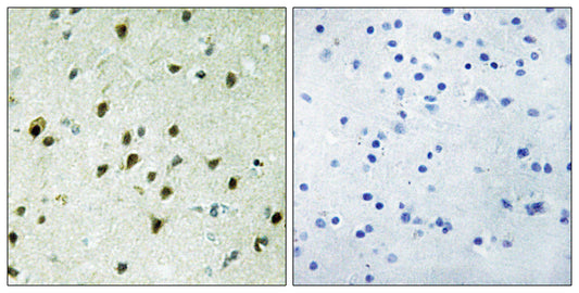 Mad 4 Rabbit Polyclonal Antibody
