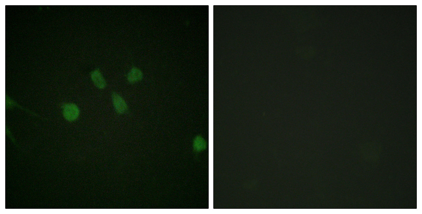MAD1 Rabbit Polyclonal Antibody