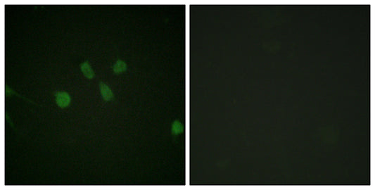 MAD1 Rabbit Polyclonal Antibody