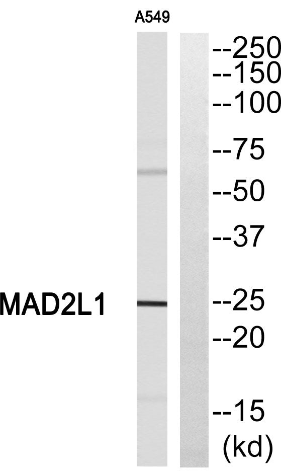 MAD2 Rabbit Polyclonal Antibody