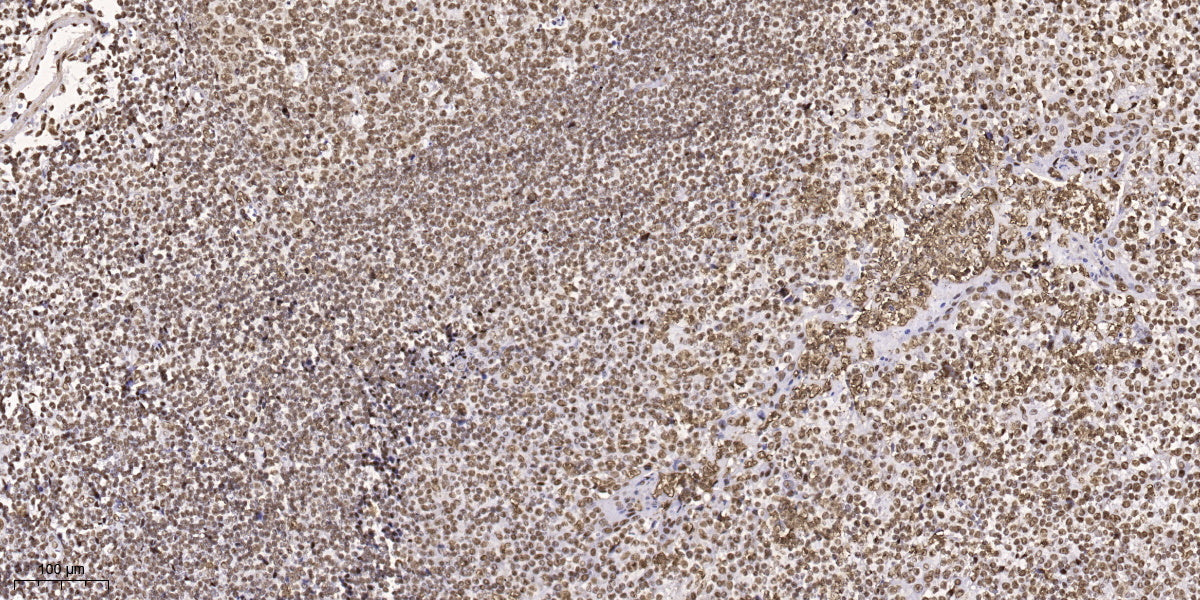 Maf1 Rabbit Polyclonal Antibody