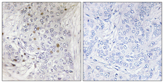 MafF Rabbit Polyclonal Antibody