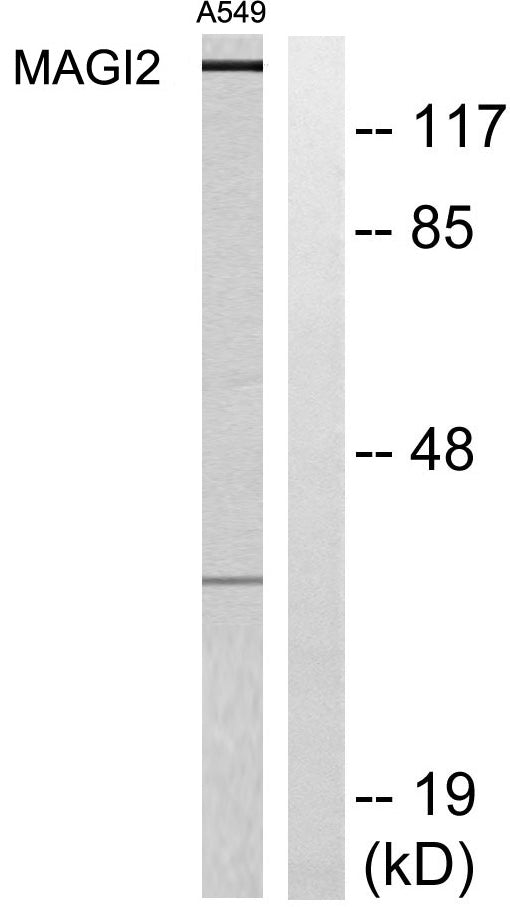 MAGI-2 Rabbit Polyclonal Antibody