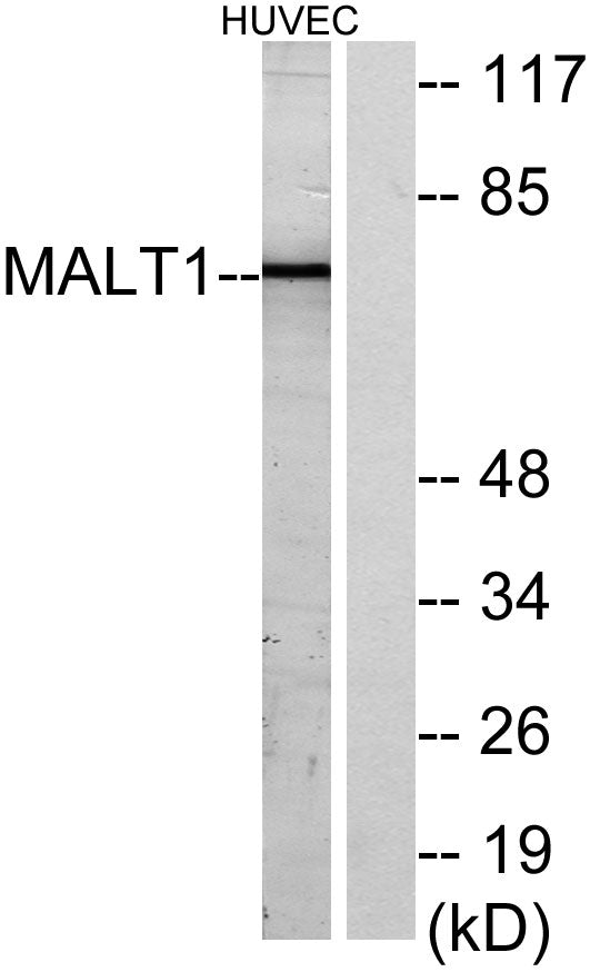 MALT1 Rabbit Polyclonal Antibody
